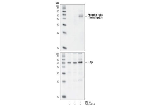 Western Blotting Image 1: Phospho-IκBβ (Thr19/Ser23) Antibody