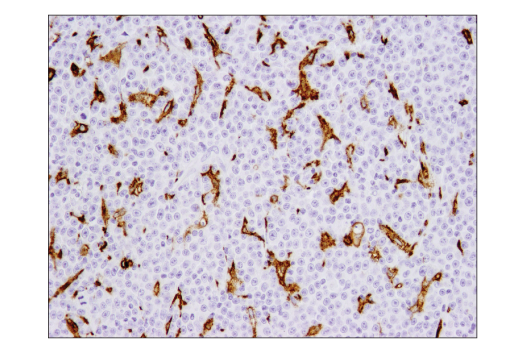 Immunohistochemistry Image 3: CD206/MRC1 (E2L9N) Rabbit mAb (BSA and Azide Free)