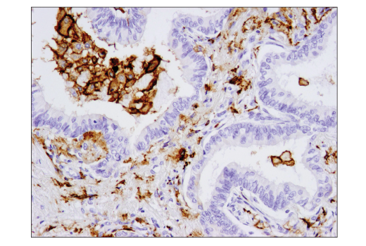 Immunohistochemistry Image 2: CD206/MRC1 (E2L9N) Rabbit mAb (BSA and Azide Free)
