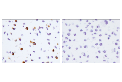 Immunohistochemistry Image 5: CD206/MRC1 (E2L9N) Rabbit mAb (BSA and Azide Free)