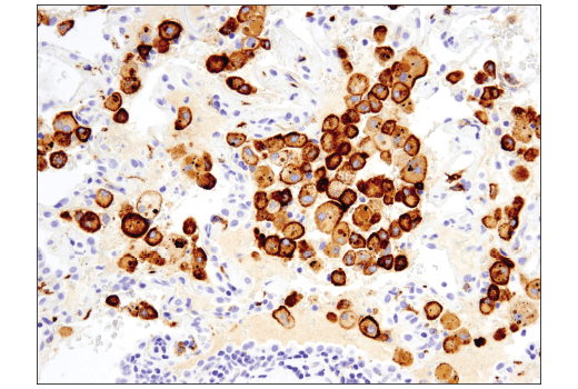 Immunohistochemistry Image 1: CD206/MRC1 (E2L9N) Rabbit mAb (BSA and Azide Free)