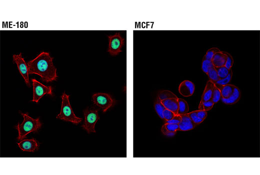 Immunofluorescence Image 1: p63-α (D2K8X) XP® Rabbit mAb (BSA and Azide Free)