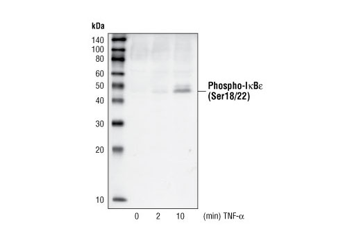 Western Blotting Image 1: Phospho-IκBε (Ser18/22) Antibody
