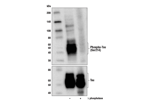 Western Blotting Image 2: Phospho-Tau (Ser214) (D1Q2X) Rabbit mAb (BSA and Azide Free)