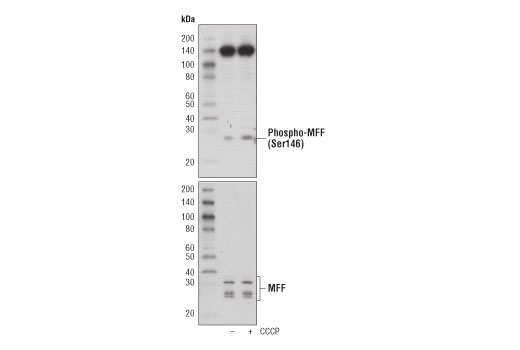 Western Blotting Image 1: Phospho-MFF (Ser146) Antibody