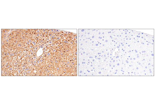  Image 31: Late-Onset Alzheimer's Disease Risk Gene (Mouse Model) Antibody Sampler Kit