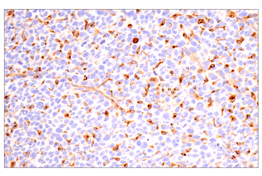  Image 29: Late-Onset Alzheimer's Disease Risk Gene (Mouse Model) Antibody Sampler Kit