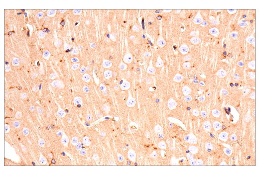  Image 5: Late-Onset Alzheimer's Disease Risk Gene (Mouse Model) Antibody Sampler Kit