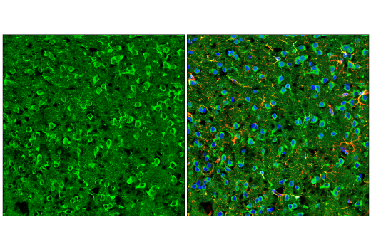  Image 8: Late-Onset Alzheimer's Disease Risk Gene (Mouse Model) Antibody Sampler Kit