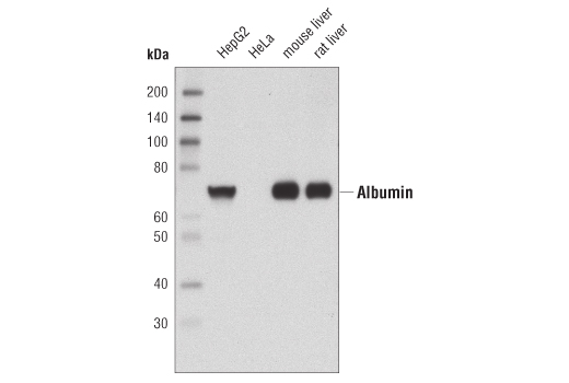 Western Blotting Image 1: Albumin Antibody