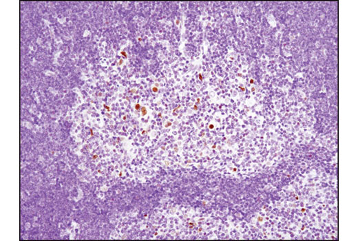 Immunohistochemistry Image 2: IRF-1 (D5E4) XP® Rabbit mAb (BSA and Azide Free)