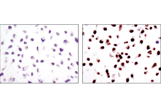 Immunohistochemistry Image 5: IRF-1 (D5E4) XP® Rabbit mAb (BSA and Azide Free)