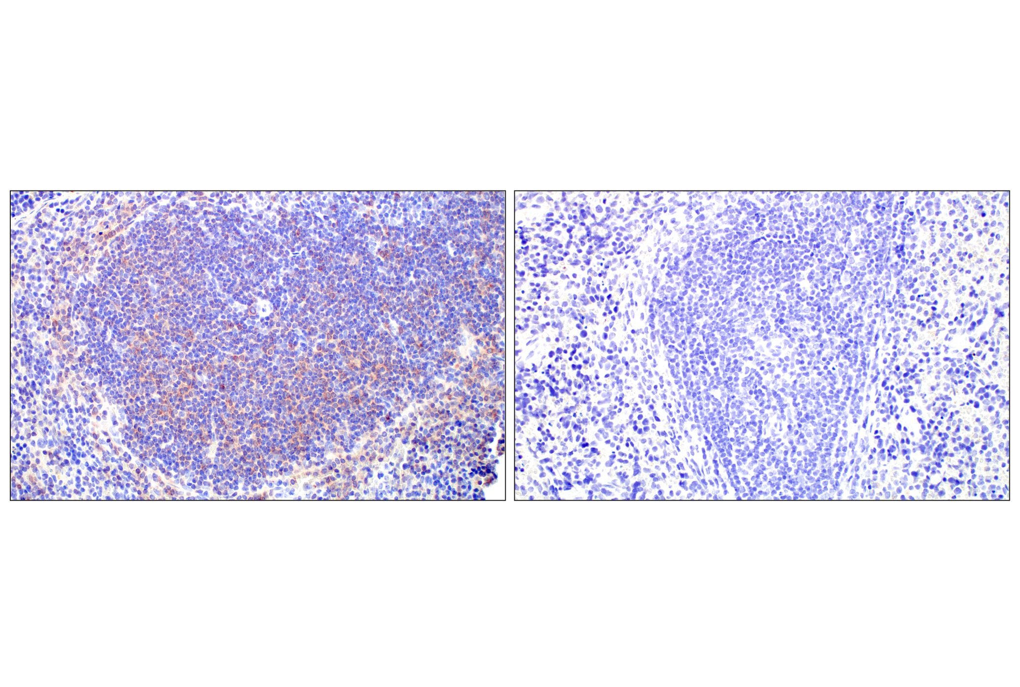 Immunohistochemistry Image 4: IgM (E8M1B) XP® Rabbit mAb (BSA and Azide Free)