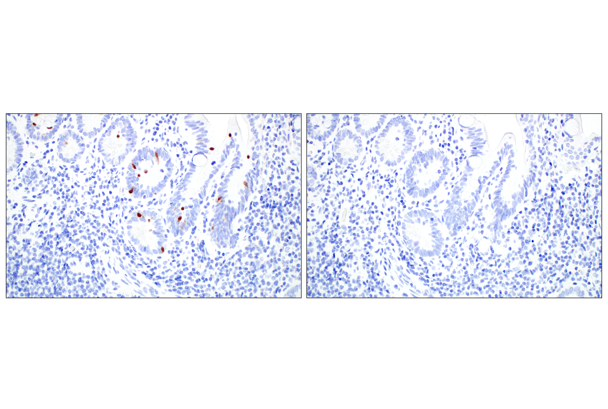 Immunohistochemistry Image 5: OCA-T1 (E4T1K) Rabbit mAb