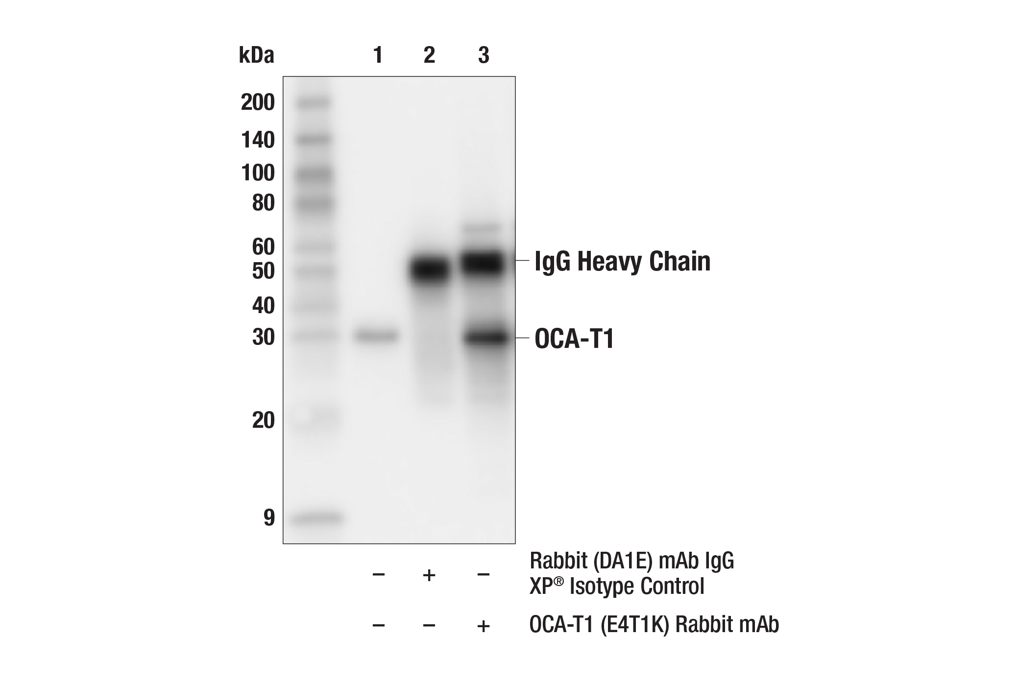 Immunoprecipitation Image 1: OCA-T1 (E4T1K) Rabbit mAb