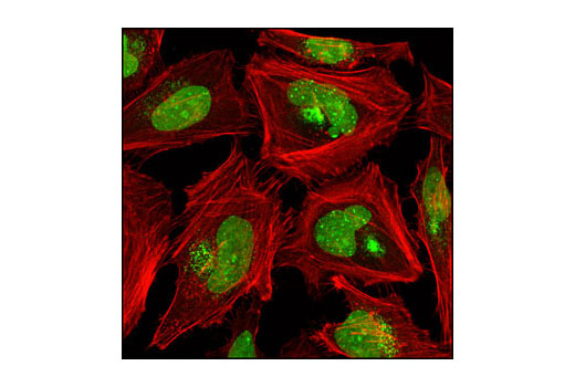 Immunofluorescence Image 1: SUMO-1 (C21A7) Rabbit mAb