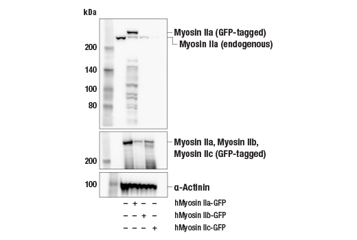 Western Blotting Image 2: Myosin IIa (E7Y9O) Rabbit mAb