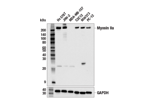 Western Blotting Image 1: Myosin IIa (E7Y9O) Rabbit mAb