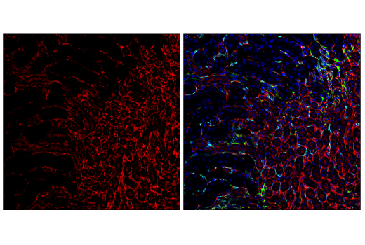 Immunofluorescence Image 2: Myosin IIa (E7Y9O) Rabbit mAb