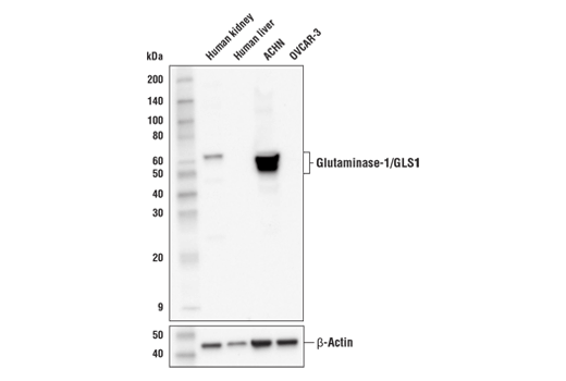 Western Blotting Image 1: Glutaminase-1/GLS1 (E4T9Q) Rabbit mAb