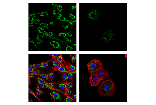 Immunofluorescence Image 1: Glutaminase-1/GLS1 (E4T9Q) Rabbit mAb
