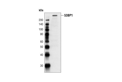 Western Blotting Image 1: 53BP1 Antibody