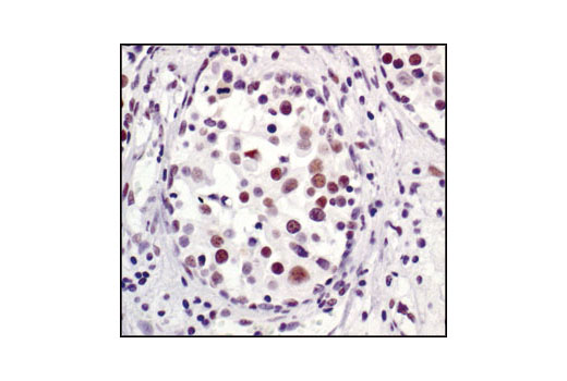 Immunohistochemistry Image 1: 53BP1 Antibody