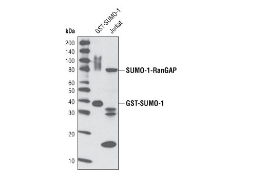  Image 5: Huntingtin Interaction Antibody Sampler Kit