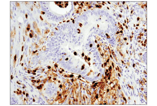Immunohistochemistry Image 3: CD11b/ITGAM (D6X1N) Rabbit mAb