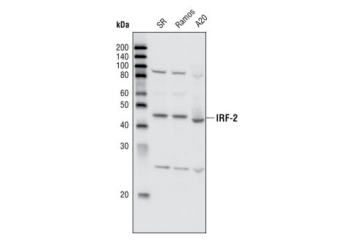  Image 5: IRF Family Antibody Sampler Kit