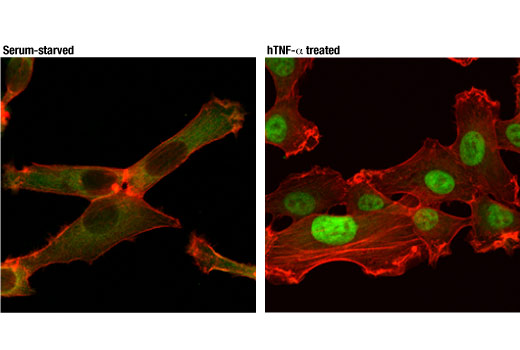 Immunofluorescence Image 1: NF-κB p65 (D14E12) XP® Rabbit mAb (Alexa Fluor® 488 Conjugate)