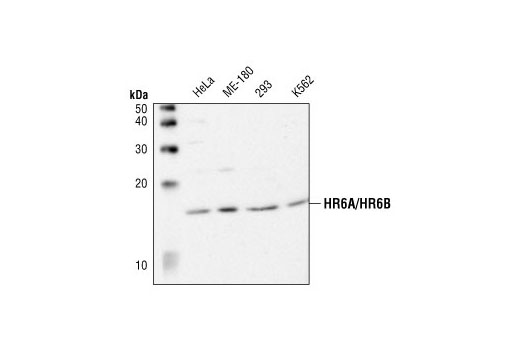 Western Blotting Image 1: HR6A/HR6B Antibody