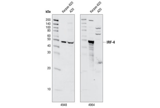 Western Blotting Image 1: IRF-4 (P173) Antibody