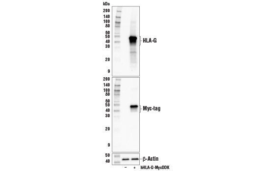 Western Blotting Image 1: HLA-G (E8N9C) XP® Rabbit mAb (BSA and Azide Free)