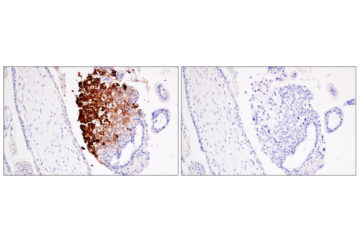 Immunohistochemistry Image 2: HLA-G (E8N9C) XP® Rabbit mAb (BSA and Azide Free)