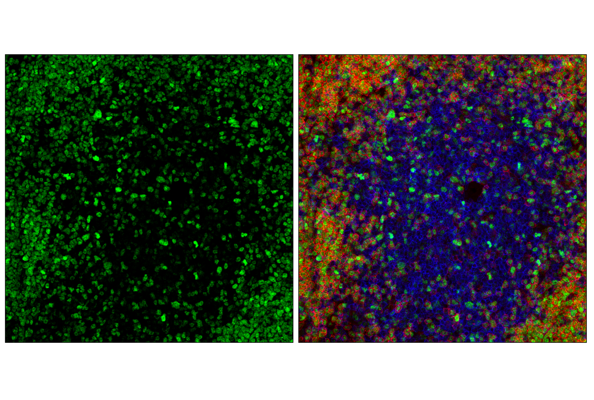 Immunofluorescence Image 2: POU2F2 (F3B7M) Rabbit mAb