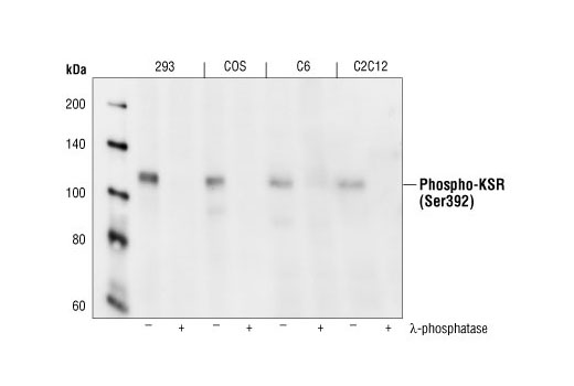 Western Blotting Image 1: Phospho-KSR1 (Ser392) Antibody