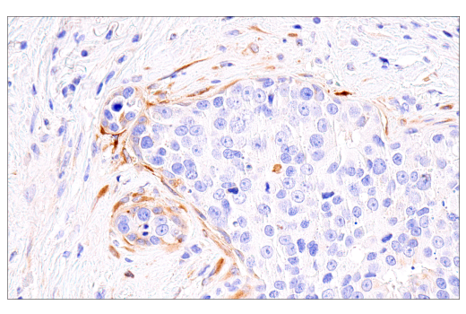 Immunohistochemistry Image 1: PAI-1 (E3I5H) XP® Rabbit mAb