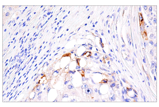 Immunohistochemistry Image 3: PAI-1 (E3I5H) XP® Rabbit mAb