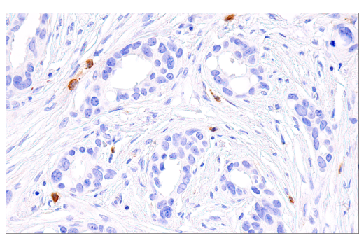 Immunohistochemistry Image 4: PAI-1 (E3I5H) XP® Rabbit mAb