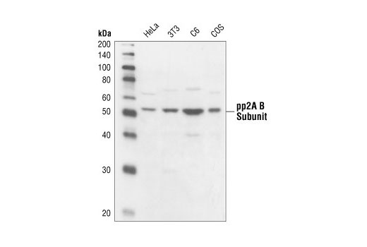 Western Blotting Image 1: PP2A B Subunit Antibody