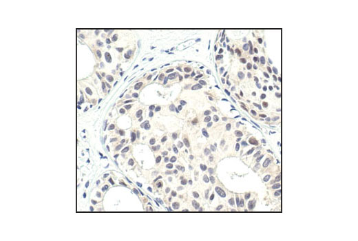 Immunohistochemistry Image 1: PP2A B Subunit Antibody