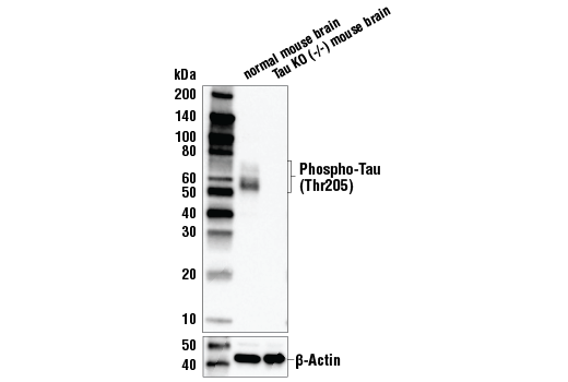  Image 7: Tau Mouse Model Neuronal Viability IF Antibody Sampler Kit