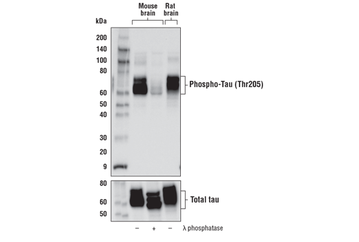  Image 15: Tau Mouse Model Neuronal Viability IF Antibody Sampler Kit