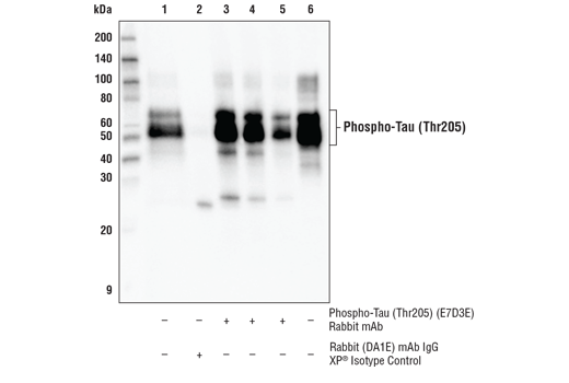 Immunoprecipitation Image 1: Phospho-Tau (Thr205) (E7D3E) Rabbit mAb
