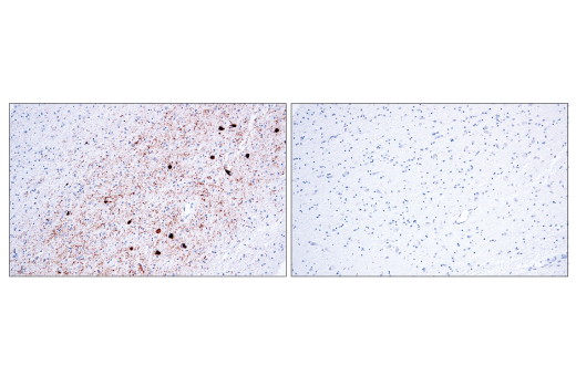  Image 35: Pathological Hallmarks of Alzheimer's Disease Antibody Sampler Kit