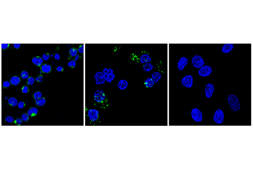 Immunofluorescence Image 1: IL-2Rγ (E1V1O) Rabbit mAb