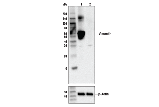 Western Blotting Image 1: Vimentin (V9) Mouse mAb