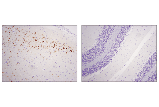  Image 19: Immature Neuron Marker Antibody Sampler Kit