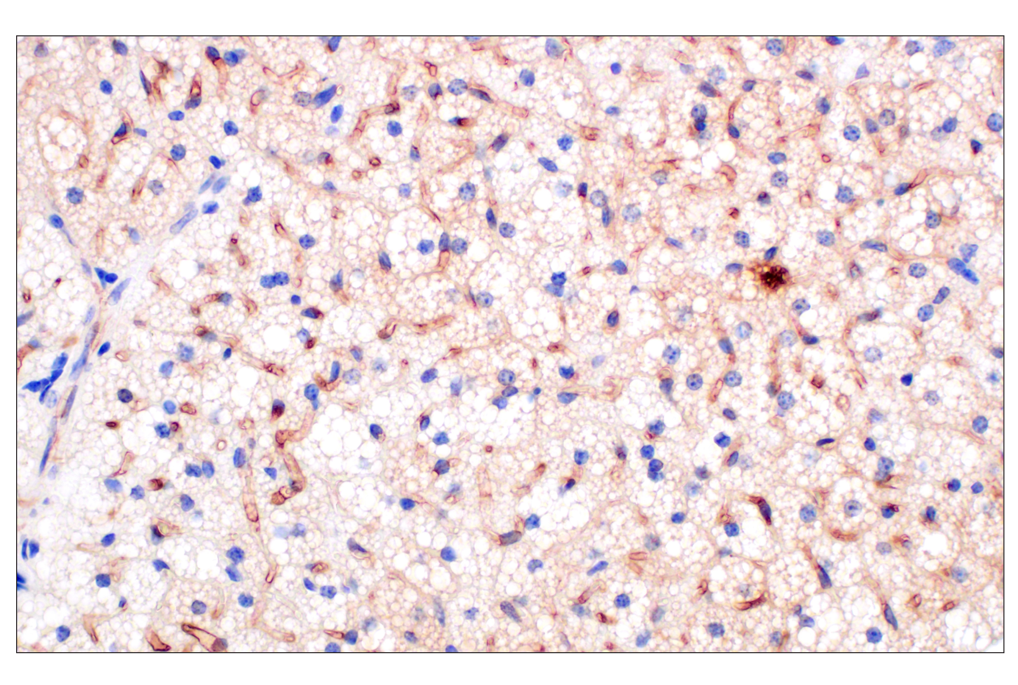 Immunohistochemistry Image 2: PNPLA3 (E7N6O) Rabbit mAb (BSA and Azide Free)